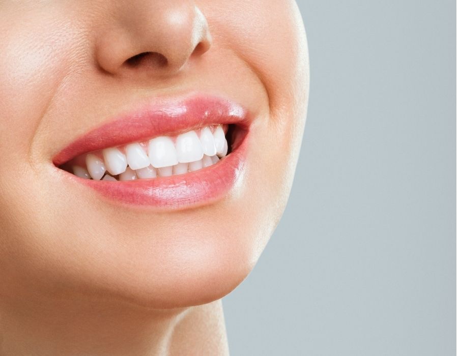 Close-up of straight white teeth after orthodontic treatment