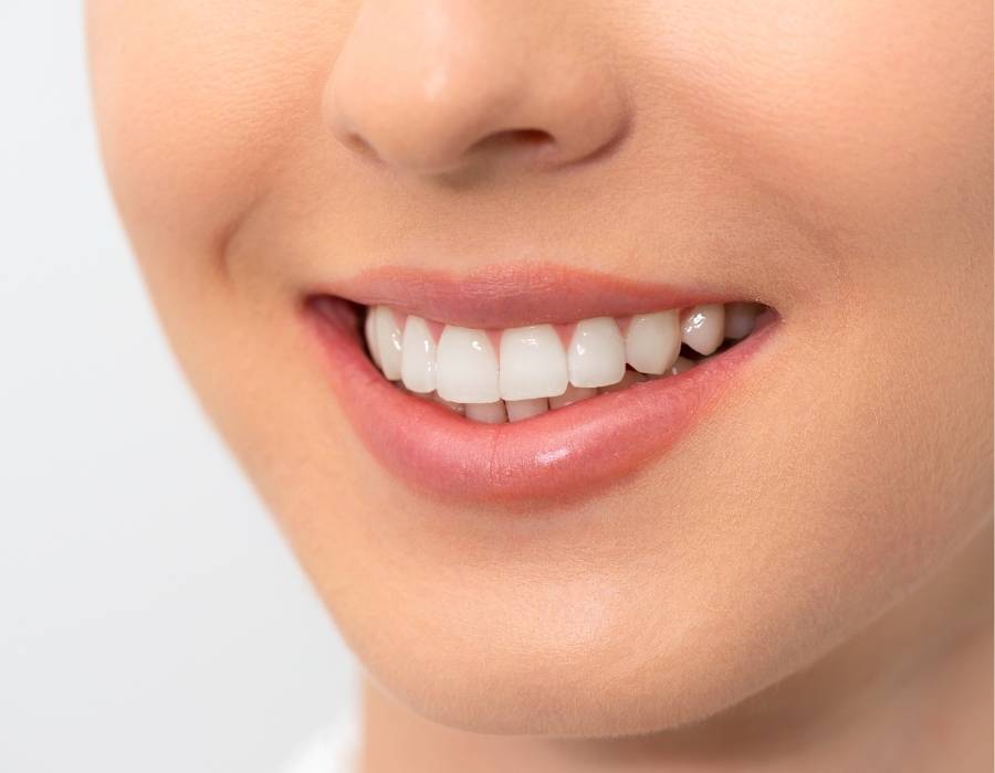 Close-up of a woman's smile showing straight, white teeth after successful orthodontic treatment.