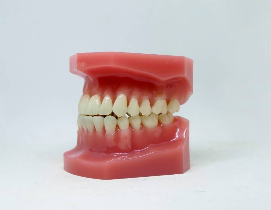 Orthodontic dental model showing healthy teeth alignment and gum structure used for educational purposes.