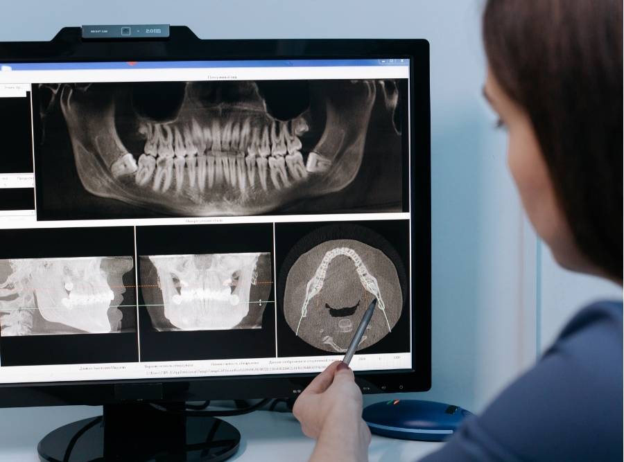 Dentist reviewing digital dental X-rays to diagnose teeth and jaw problems in Bluffton SC