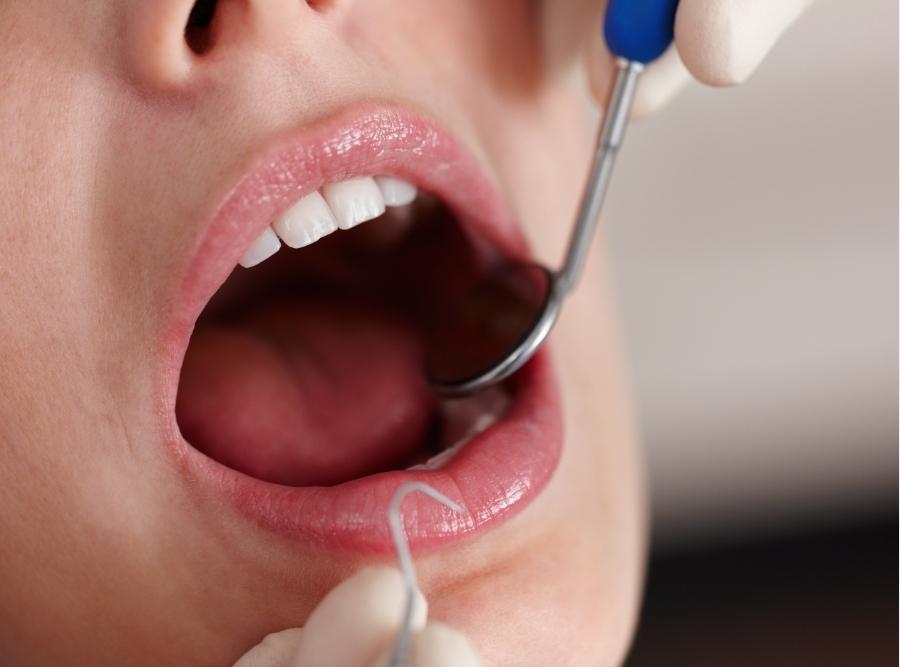 examing teeth for free consultation