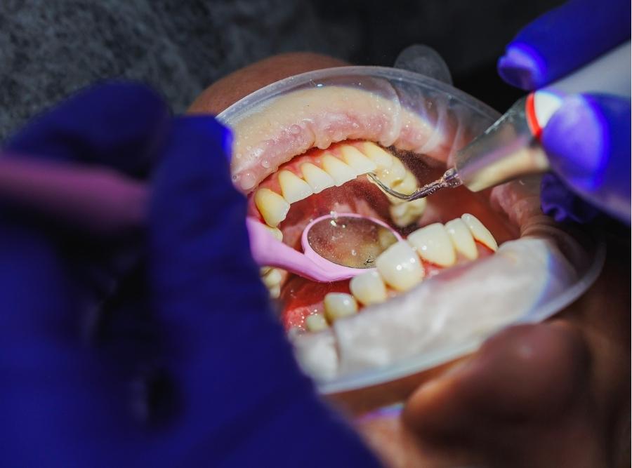 performing adult orthodontic treatment