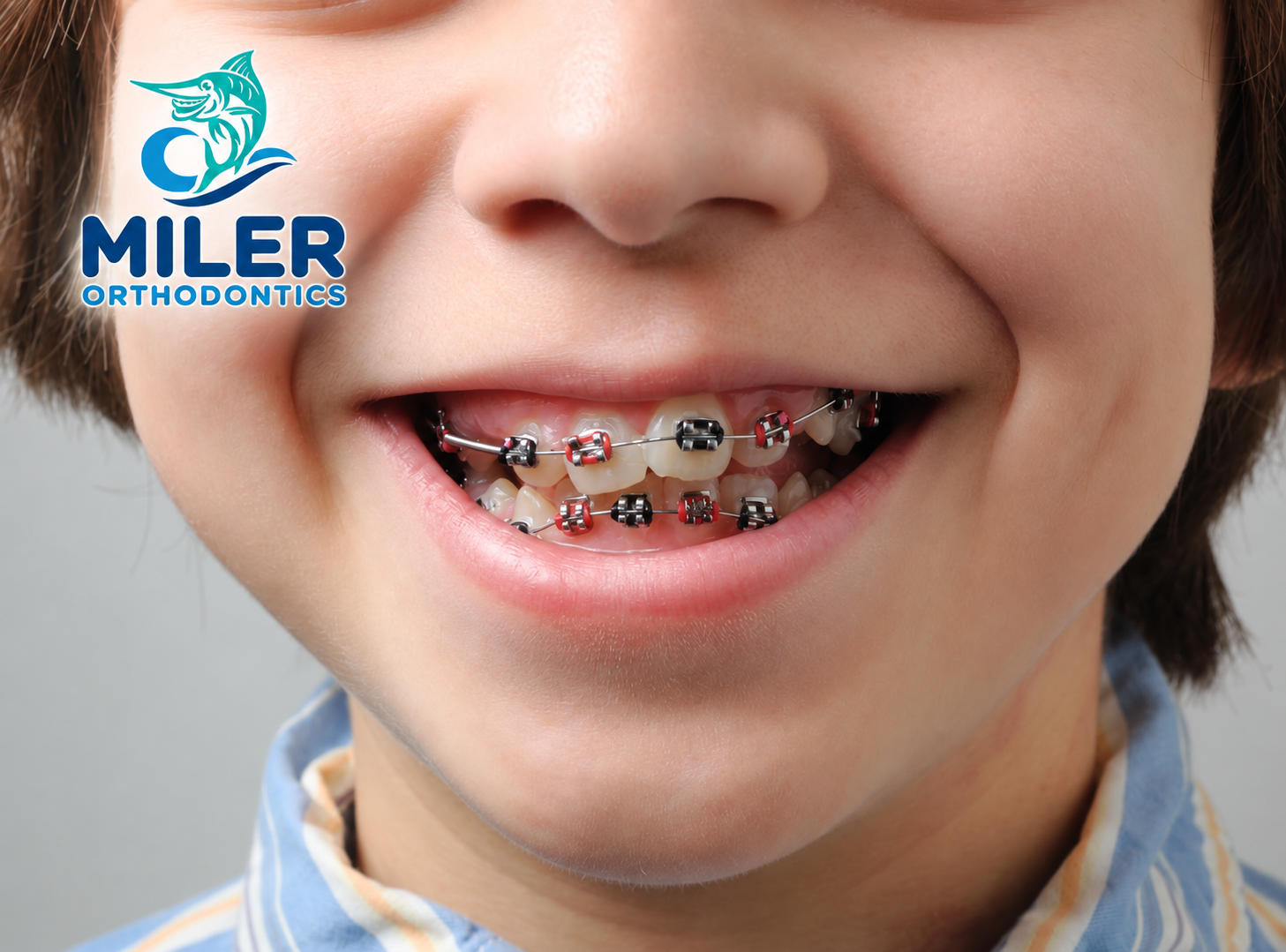 early age braces