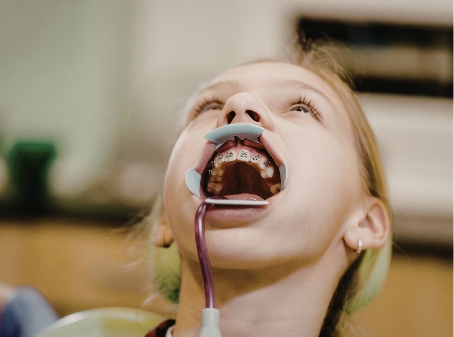 young girl braces installation